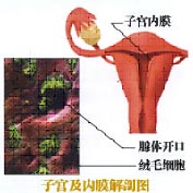 女性生殖系统四大癌变之子宫内膜癌