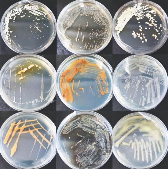 放线菌菌落颜色图片